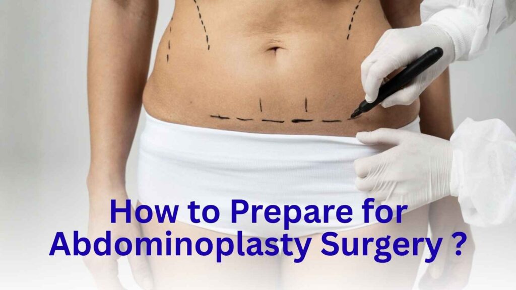Preoperative markings being made on the abdomen before abdominoplasty surgery to plan the surgical procedure.