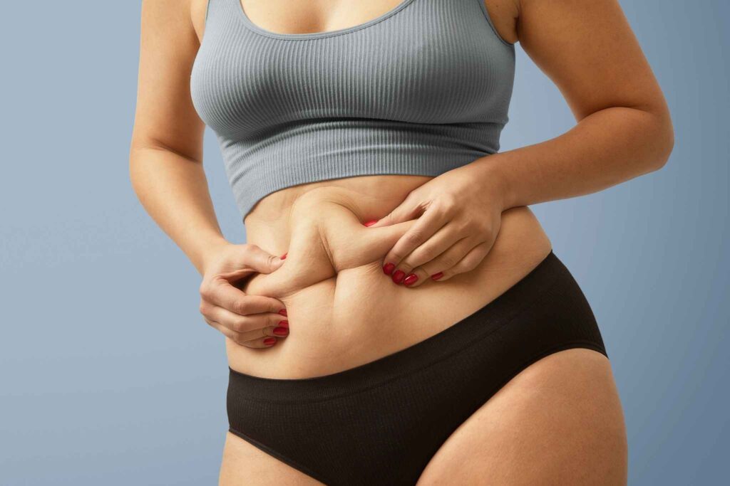 Close-up of a woman holding excess abdominal fat around the stomach, showing localized belly fat.