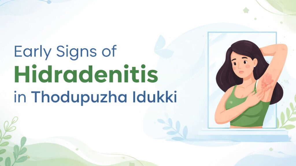 Early Signs of Hidradenitis in Thodupuzha Idukki illustration showing underarm skin condition