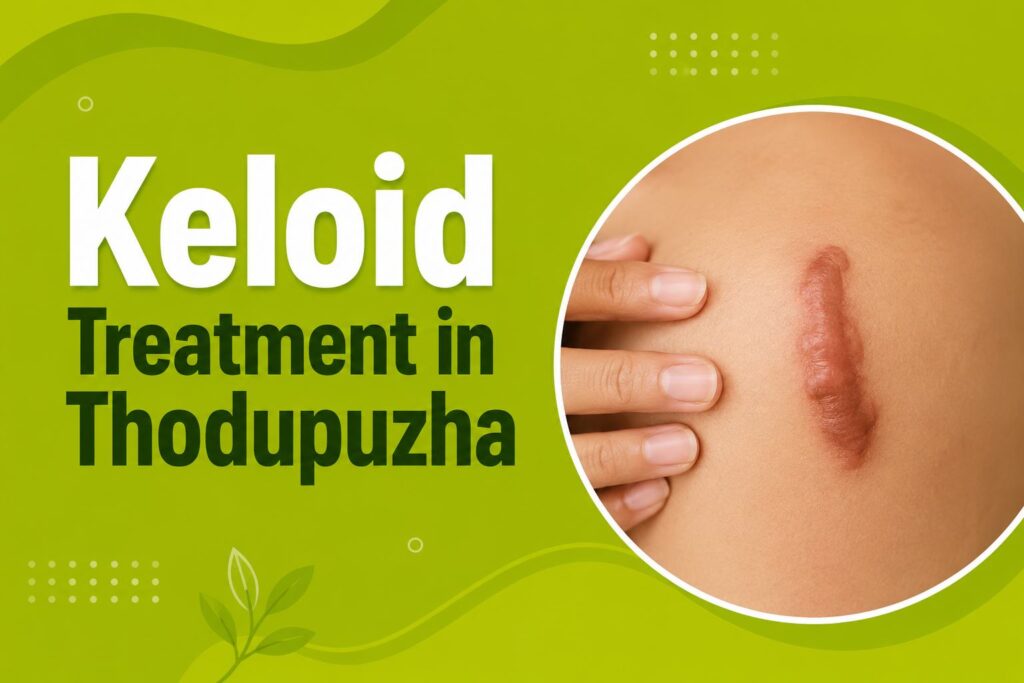 Keloid Treatment in Thodupuzha showing a raised keloid scar on the skin