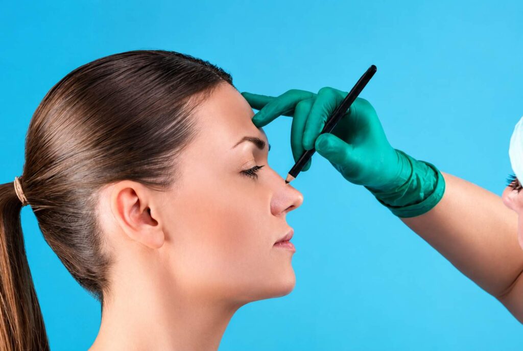 How Long Rhinoplasty Recovery Takes – Patient undergoing pre-operative rhinoplasty assessment with a surgeon marking the nose for reshaping surgery in a modern cosmetic surgery clinic.